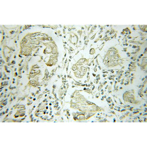B4GALT3 Rabbit Polyclonal Antibody (11041-1-AP)