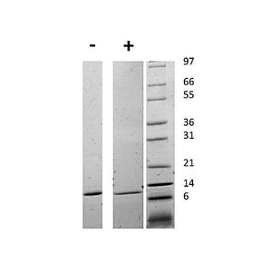 Human Migration Inhibitory Factor Recombinant Protein