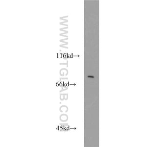 BBS10 Rabbit Polyclonal Antibody (12421-2-AP)