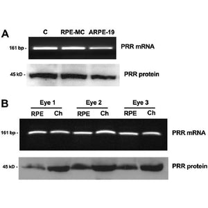 ATP6AP2 Rabbit Polyclonal Antibody (10926-1-AP)