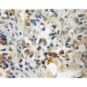 STOML1 Rabbit Polyclonal Antibody (12862-1-AP)