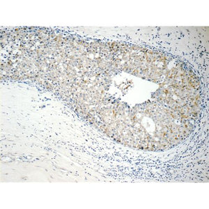 RABL3 Rabbit Polyclonal Antibody (11916-1-AP)