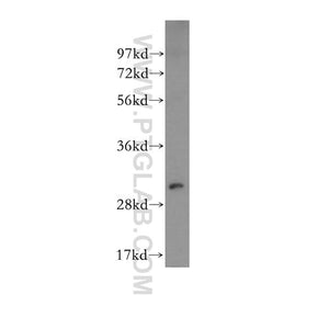 NQO1 Rabbit Polyclonal Antibody (11451-1-AP)