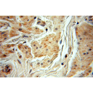 MYEOV Rabbit Polyclonal Antibody (11151-1-AP)