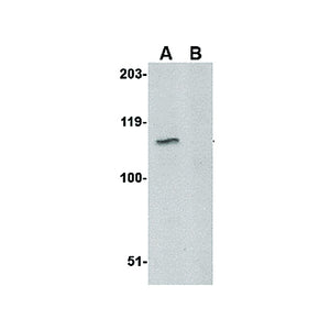 GPVI Antibody cterm 100µg