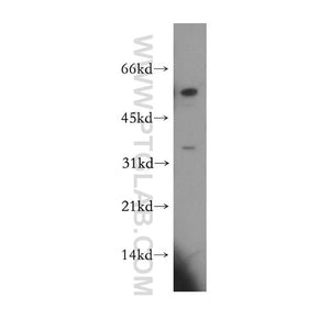 CCDC28B Rabbit Polyclonal Antibody (11530-1-AP)