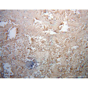 FUT8 Rabbit Polyclonal Antibody (12560-1-AP)