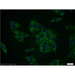 MTMR8 Rabbit Polyclonal Antibody (12299-1-AP)