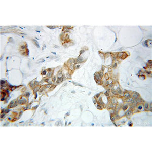 PSAT1 Rabbit Polyclonal Antibody (10501-1-AP)