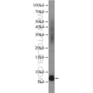 ADM Rabbit Polyclonal Antibody (10778-1-AP)