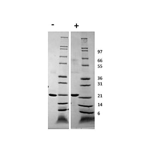 Human Growth Hormone Recombinant Protein