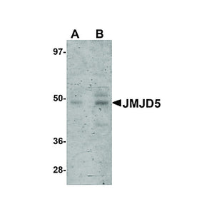 Anti-JMJD5 (RABBIT) Antibody, 100µg, Liquid (sterile filtered)