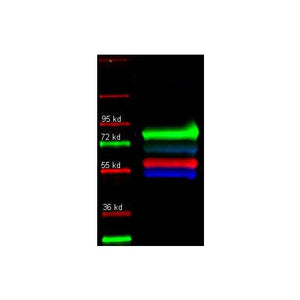 Anti-ALPHA-1-ANTI-TRYPSIN (Human Plasma) (GOAT) Antibody