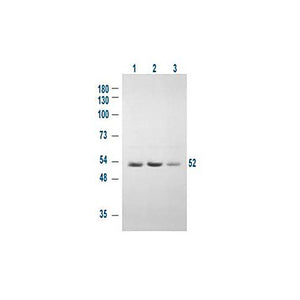 Anti-GSK3 alpha pS21 (RABBIT) Antibody, 100µg, Liquid (sterile filtered)