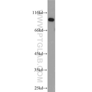 UBE3A Rabbit Polyclonal Antibody (10344-1-AP)