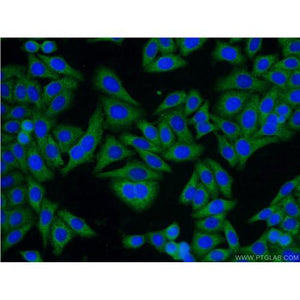 GNB1 Rabbit Polyclonal Antibody (10247-2-AP)