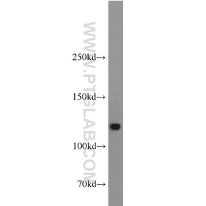 DHX16 Rabbit Polyclonal Antibody (11021-1-AP)