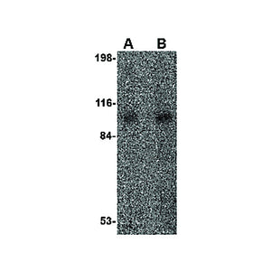 VPS53 Antibody internal 100µg