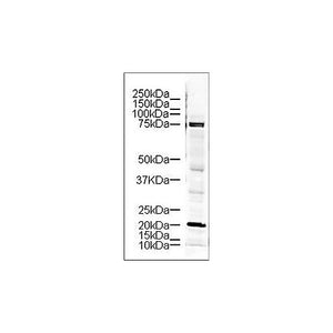 Anti-LIM Kinase (RABBIT) Antibody, 100µg, Liquid (sterile filtered)