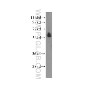 STK32C Rabbit Polyclonal Antibody (11434-1-AP)