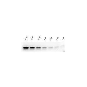 Western Blot Kit Chemiluminescent Western Blot Kit