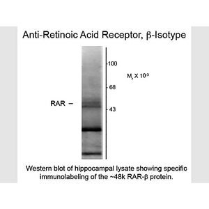 Anti-Retinoic Acid Receptor beta (Mouse) Monoclonal Antibody, 100µL, Liquid