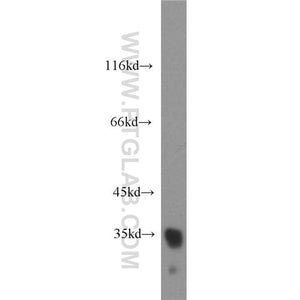 DDIT4 Rabbit Polyclonal Antibody (10638-1-AP)