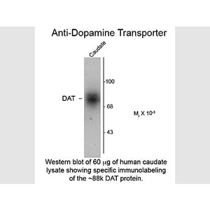 Dopamine Transporter (cterm) 100µL