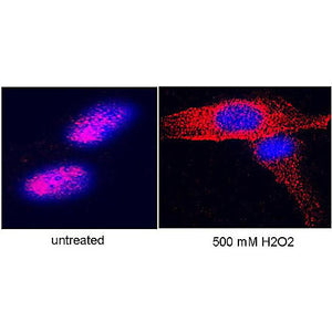 Anti-Telomerase catalytic subunit (RABBIT) Antibody