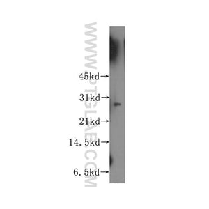 APIP Rabbit Polyclonal Antibody (12089-2-AP)