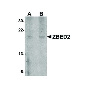 Anti-ZBED2 (RABBIT) Antibody, 100µg, Liquid (sterile filtered)