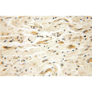 EFHD2 Rabbit Polyclonal Antibody (12181-1-AP)