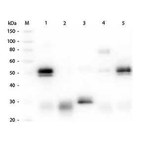 Anti-RABBIT IgG (H&L) (GOAT) Antibody Biotin Conjugated (Min X Human Serum Proteins), 500µg, Lyophilized