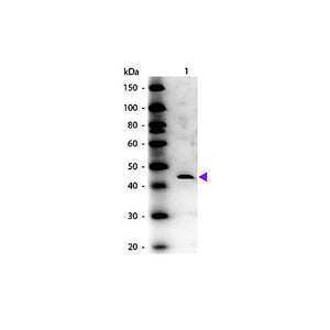 Anti-ADENOSINE DEAMINASE (Calf Spleen) (RABBIT) Antibody