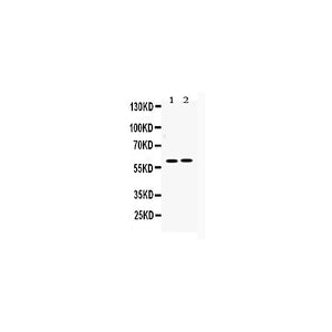 Anti-AKT1 Picoband™ Antibody