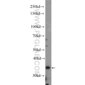 DBP Rabbit Polyclonal Antibody (12662-1-AP)