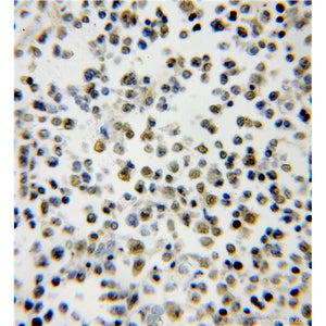 SMNDC1 Rabbit Polyclonal Antibody (12178-1-AP)