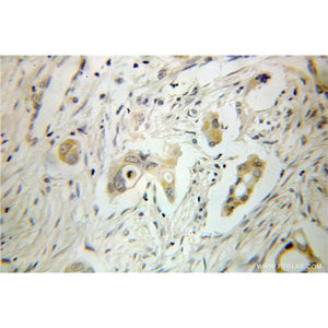 GSTA2 Rabbit Polyclonal Antibody (10505-1-AP)