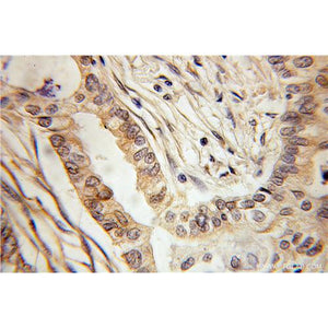 KLRC1 Rabbit Polyclonal Antibody (10935-1-AP)