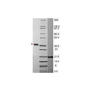 VEGF-165 Human Recombinant Protein